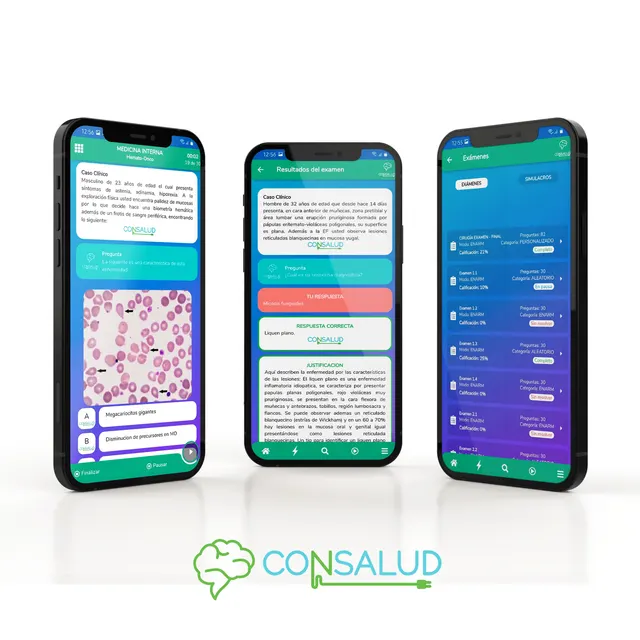 Simulador ENARM Prime en la app Consalud