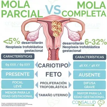 Ultra resumen o flashcard Consalud 7